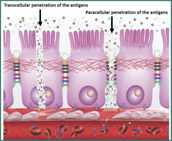 intestinal permeability