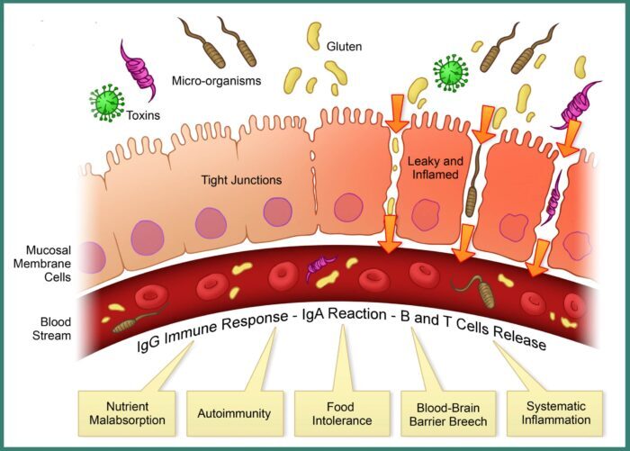 intestinal permeability