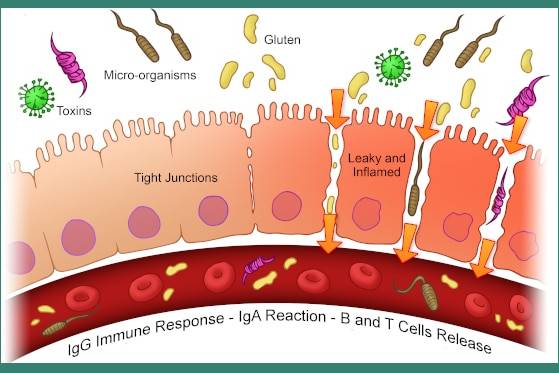 intestinal permeability