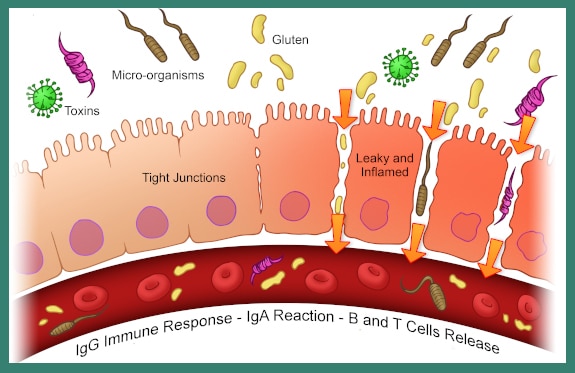 intestinal permeability