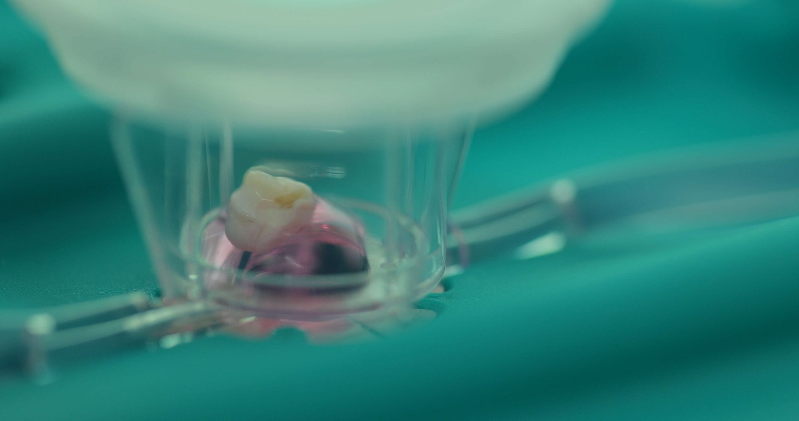 r4l-MIVObiopsies