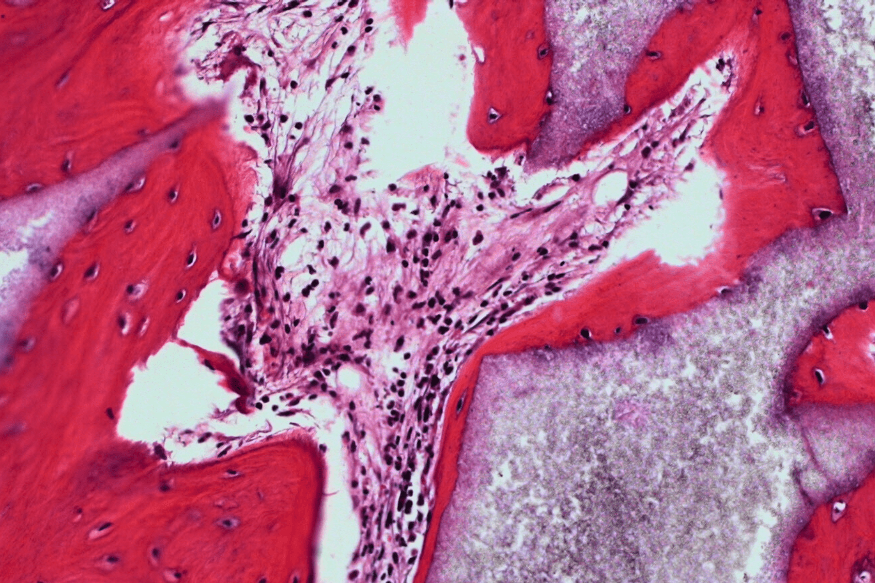 Biomaterials