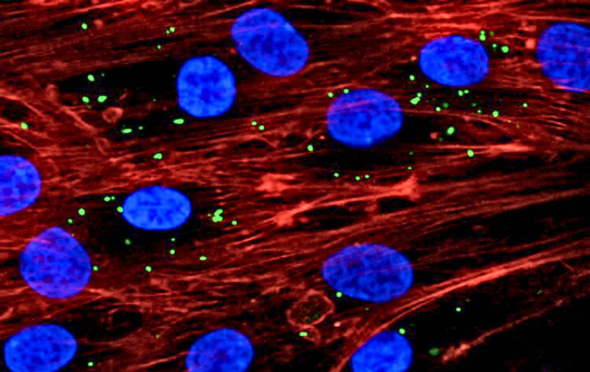 Vesicles internalization