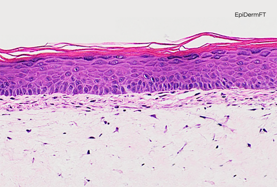skin on chip 3D Reconstructed tissues