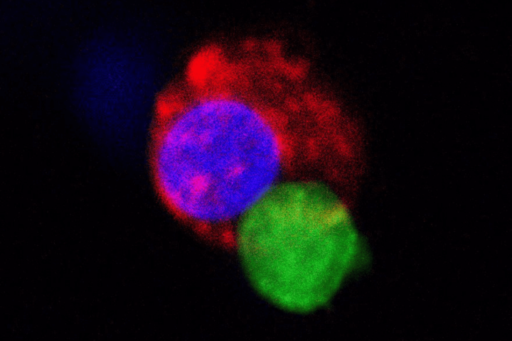 Immuno Oncology IMMUNE CELLS INFILTRATION