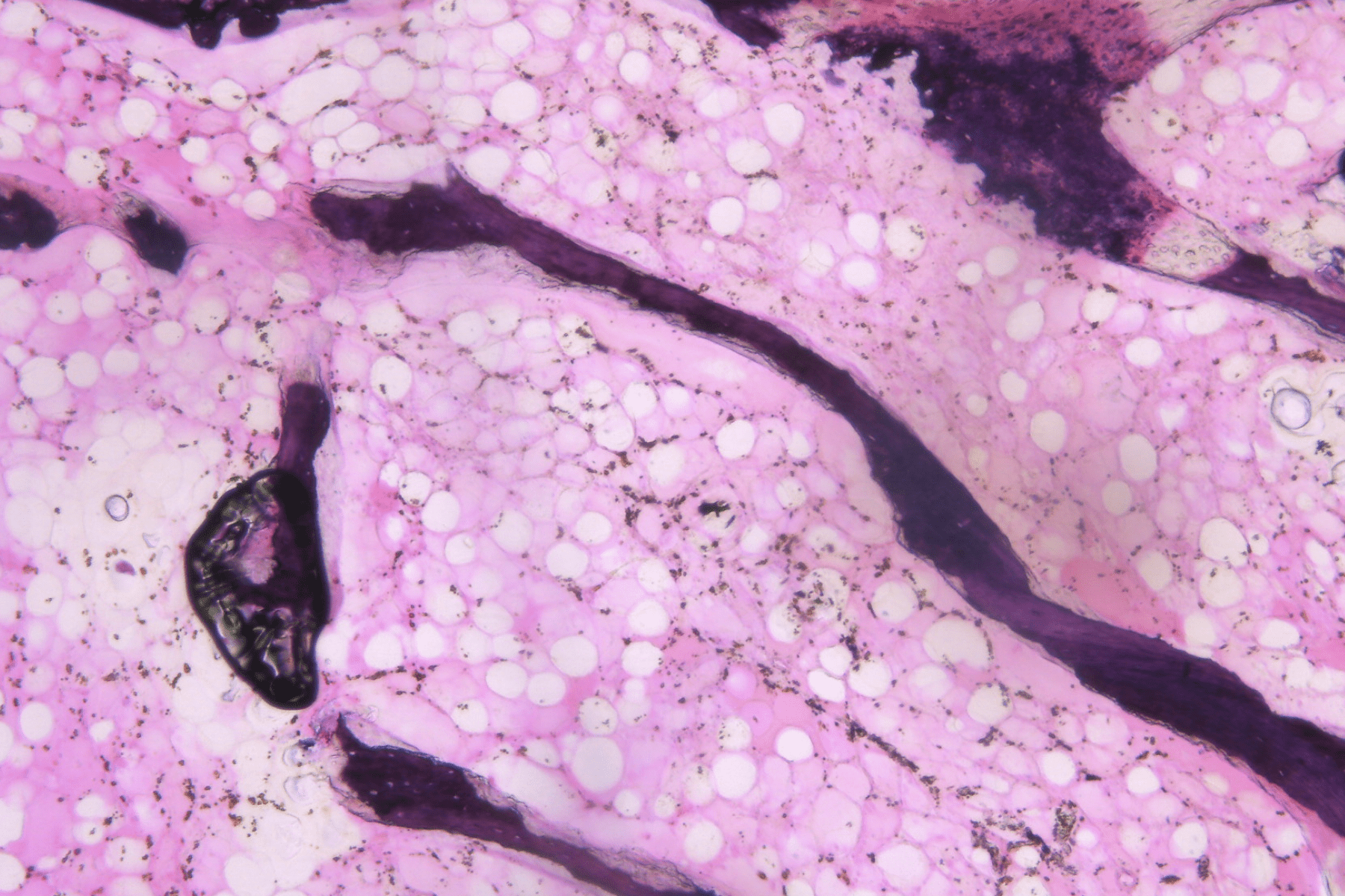 Patient derived biopsy