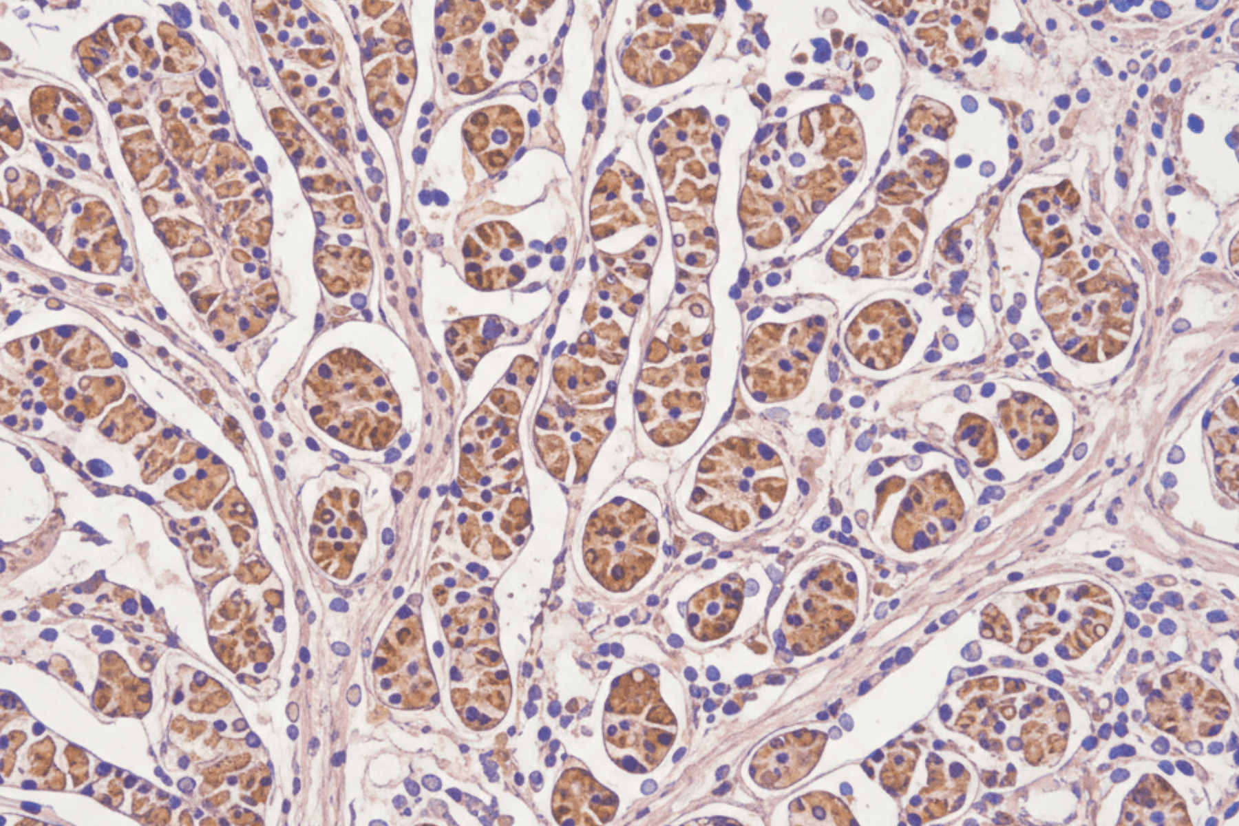 Biopsy