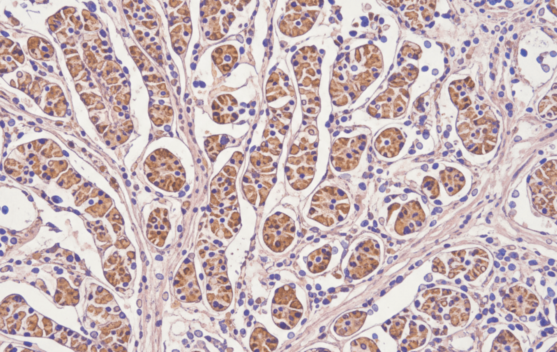 Biopsy