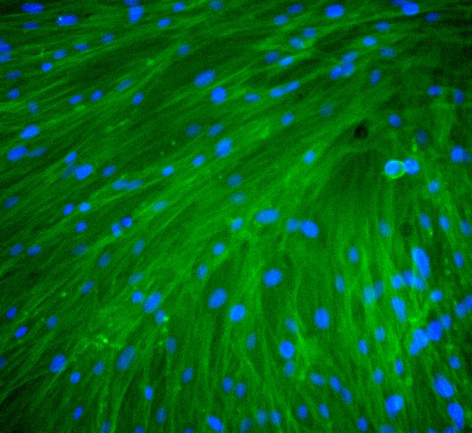 Leaky Gut on chip