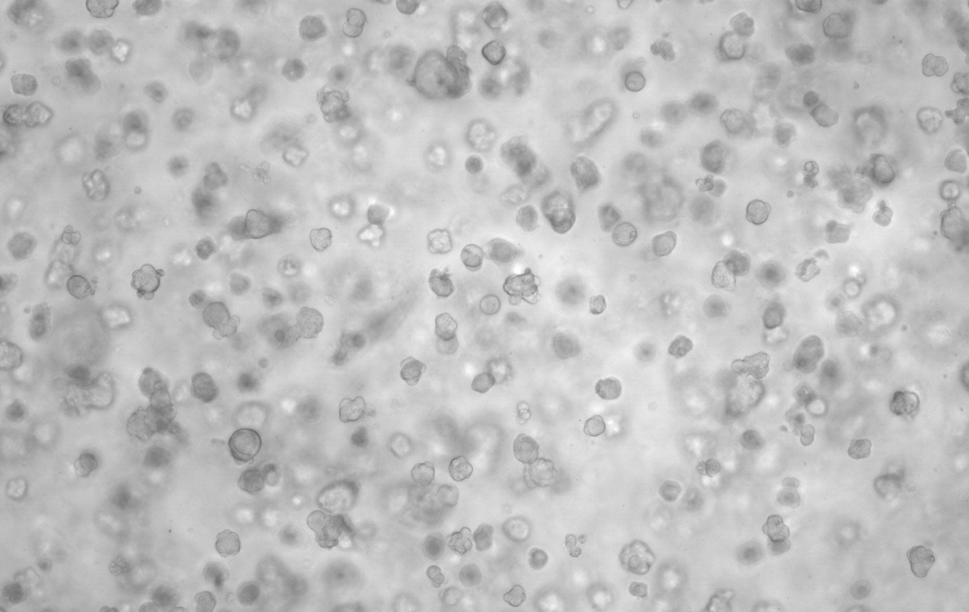 cancer on chip Matrix based tumor models