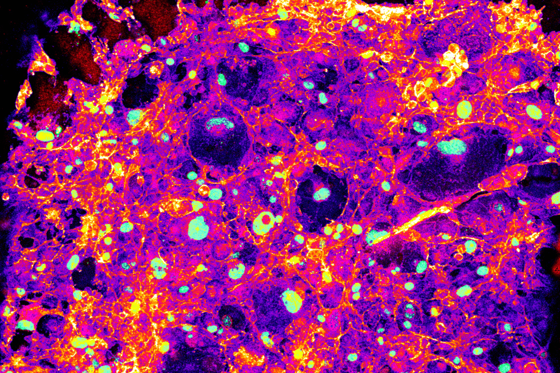 Organoids