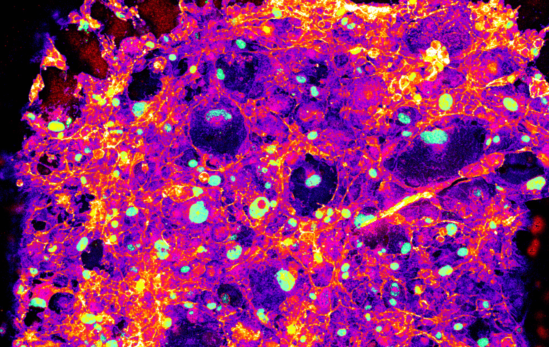 Organoids