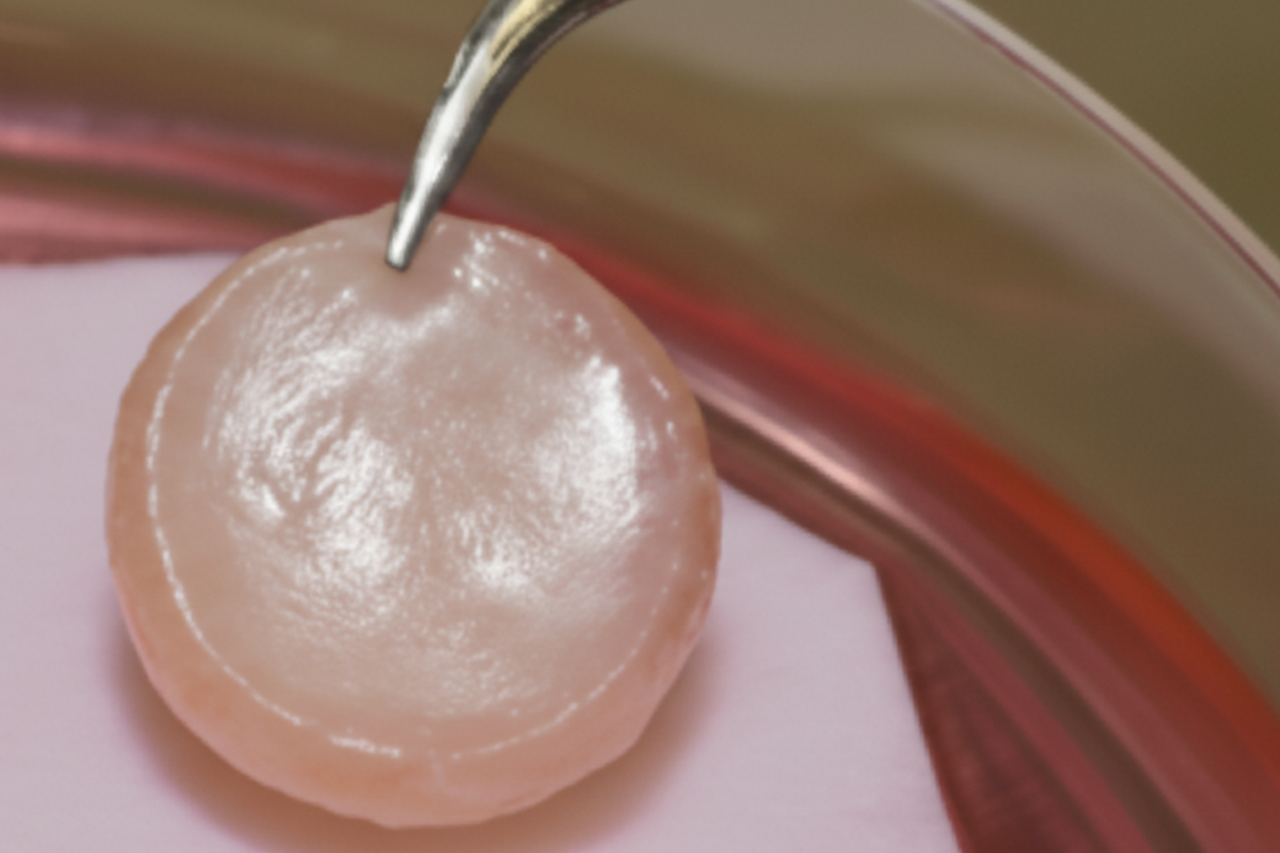 Skin Biopsy