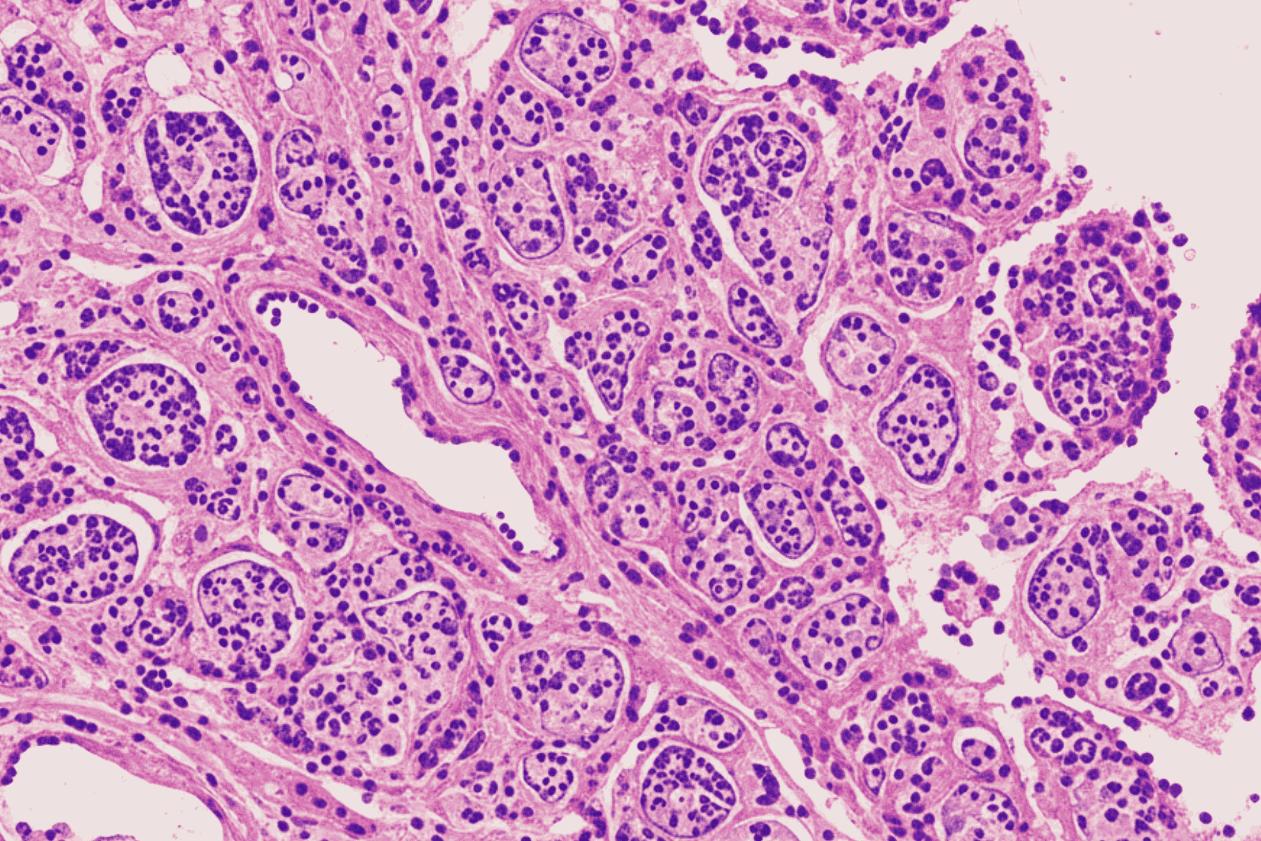 Tissue Slice