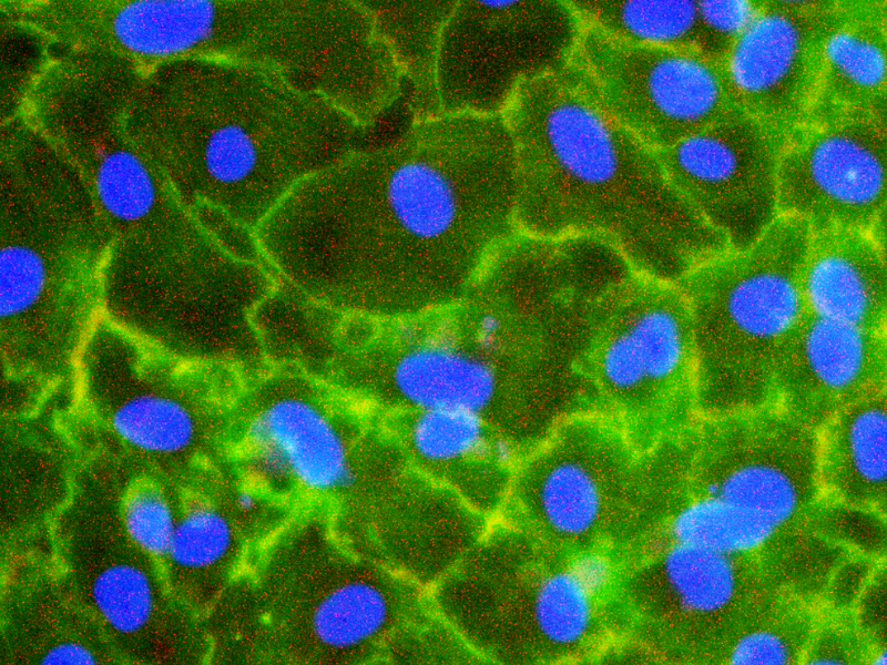 Tumor cells invasion assay