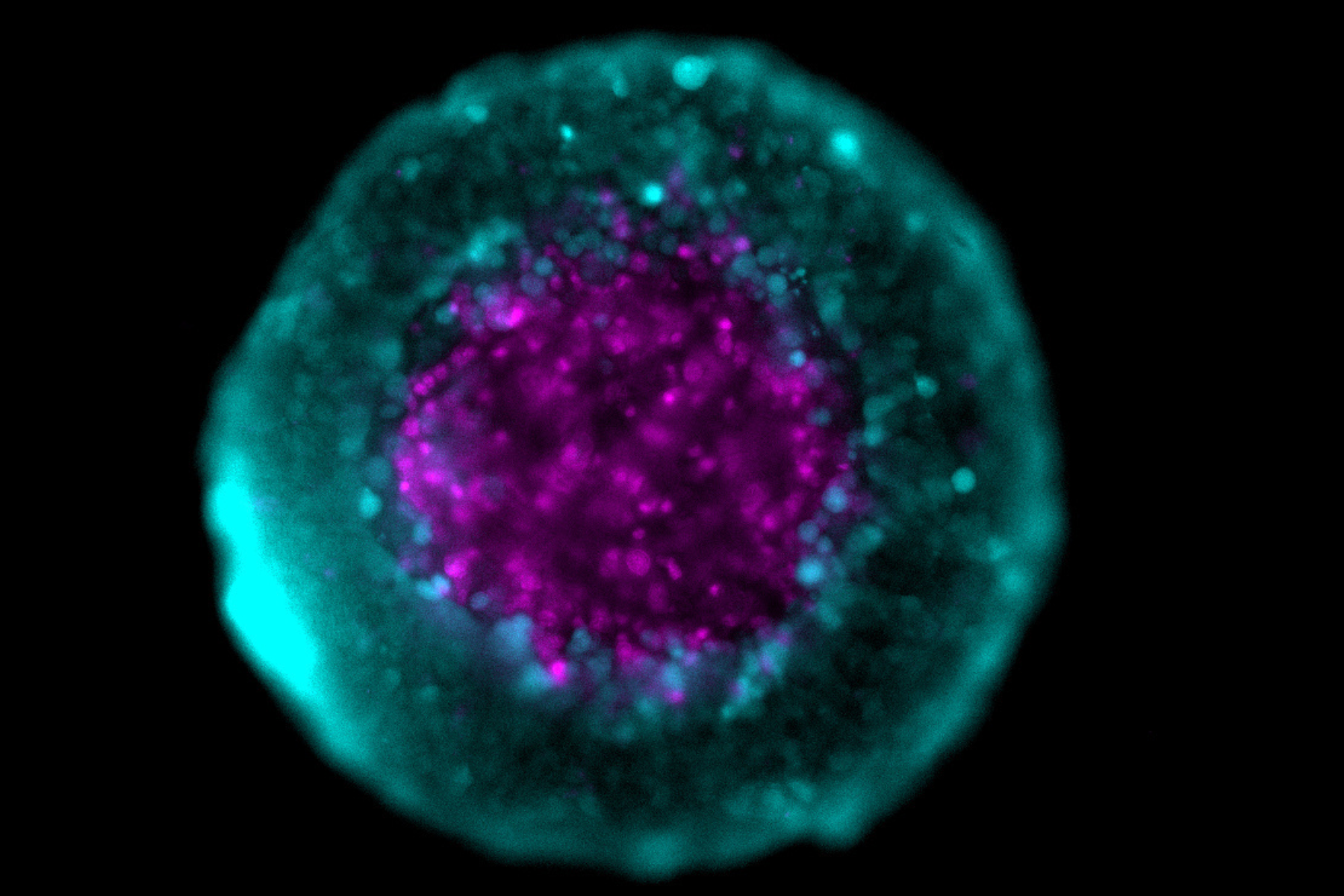 spheroid