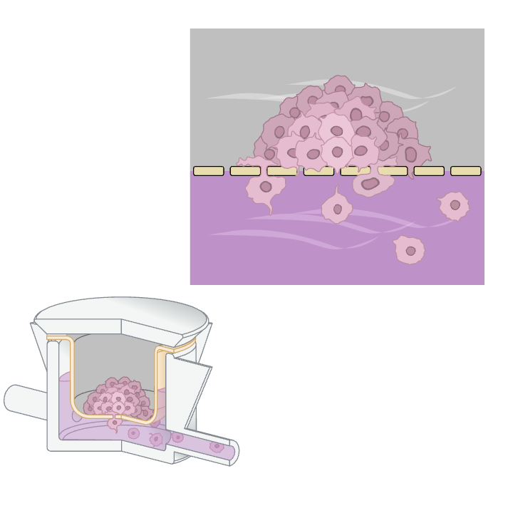 Tumor Cells Invasion